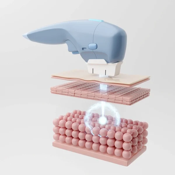 چگونگی تاثیر هایفوتراپی روی پوست