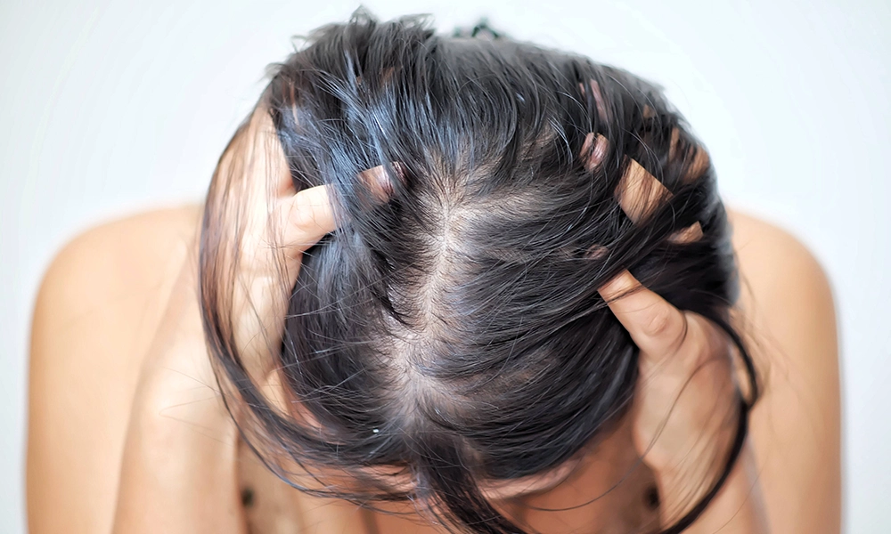 نازک شدن مو