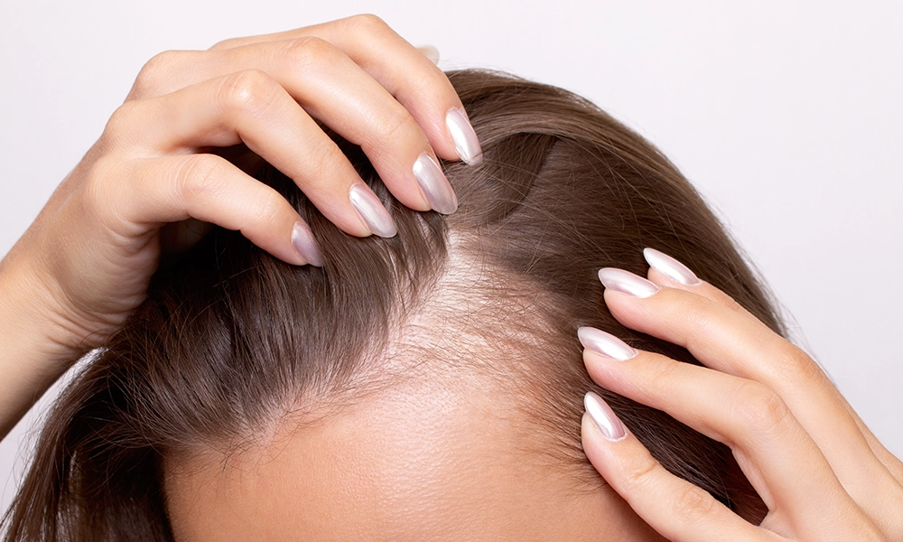 نازک شدن مو جلوی سر