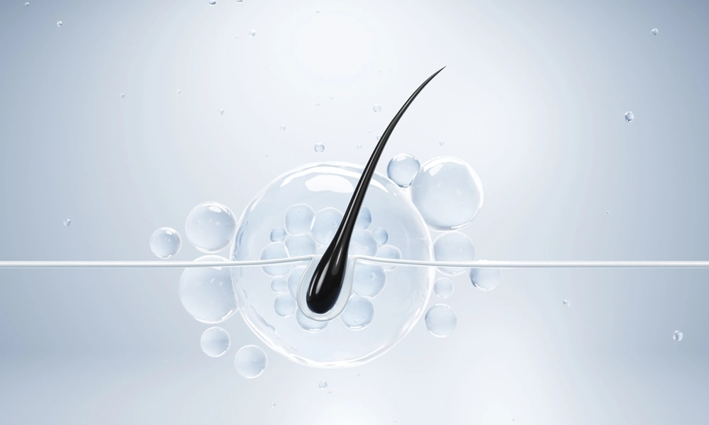 تصویر پیاز مو