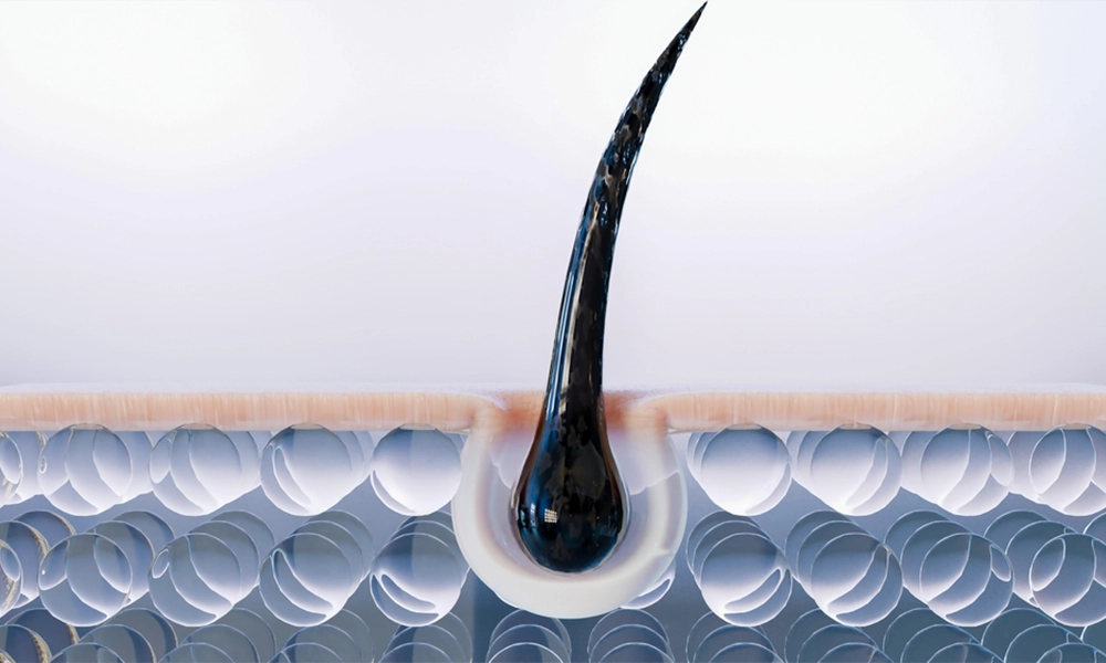 تقویت پیاز مو