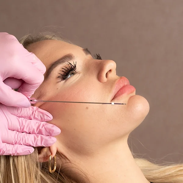 شکل عمل زیبایی لیفت نخ در کنار خانم متقاضی