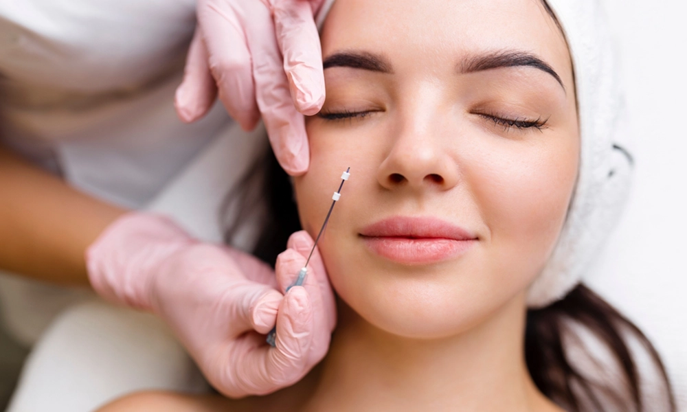 عکس لیفت نخ صورت در ناحیه گونه