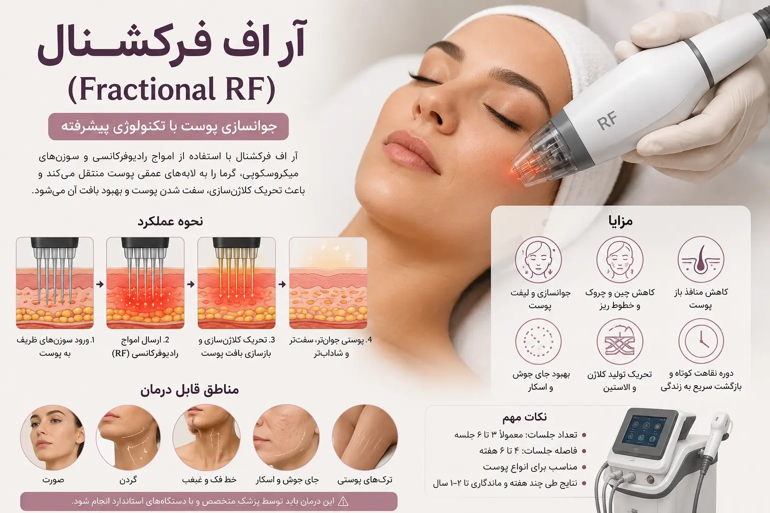 what-is-rf-frectional