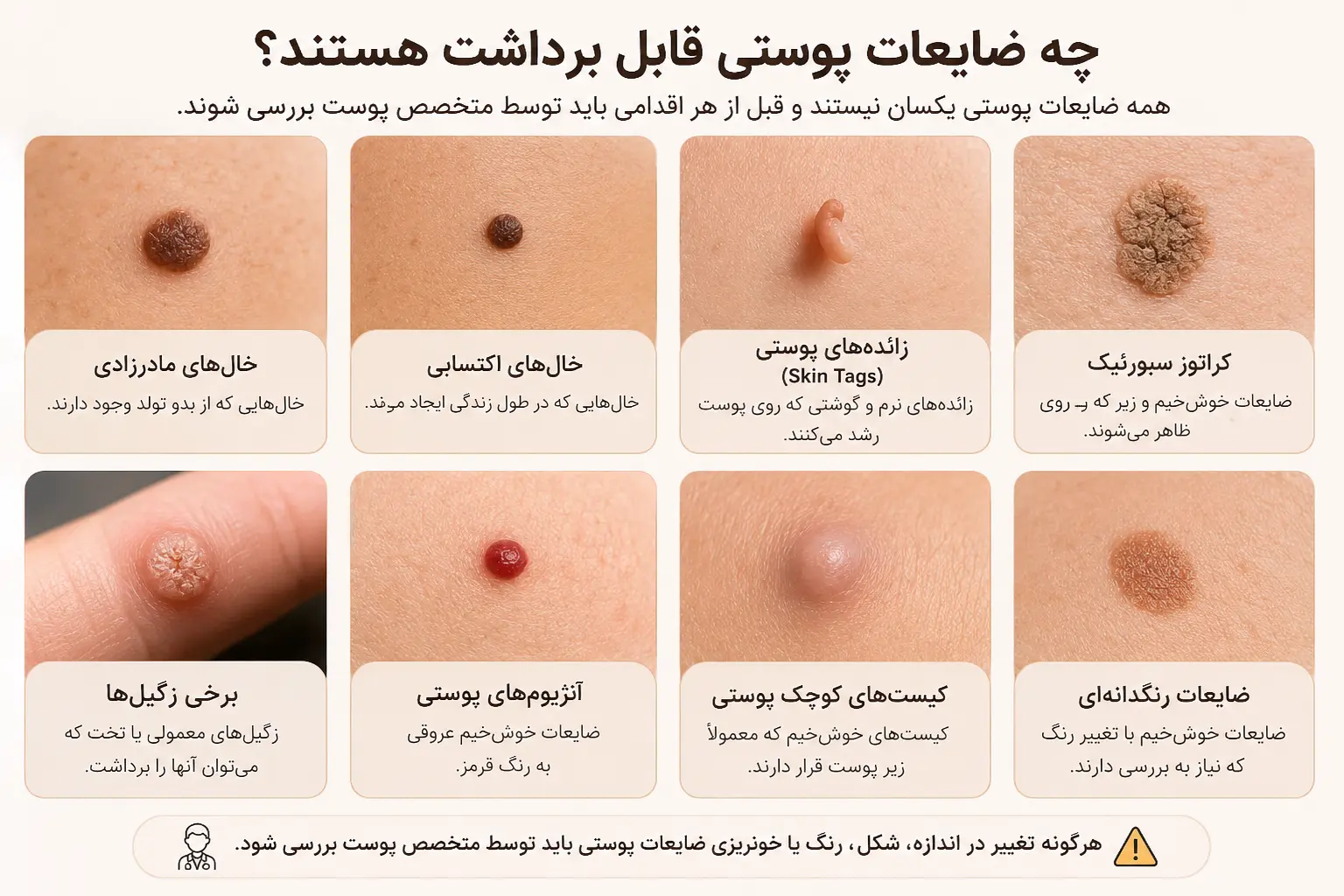 انواع خال و ضایعات پوستی