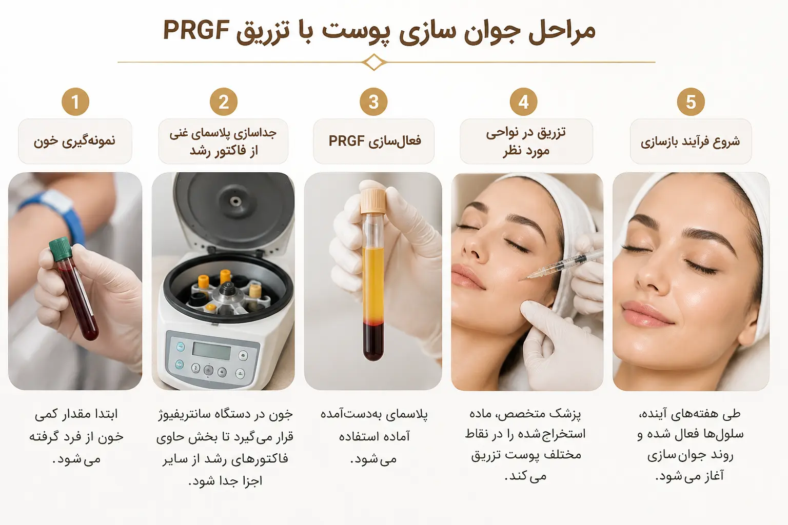 مراحل جوان سازی پوست PRGF