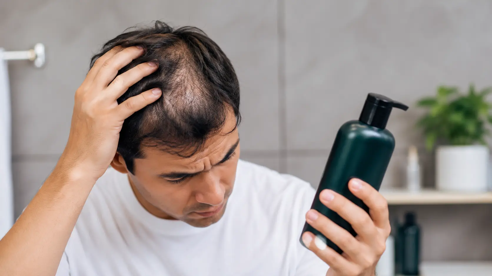 تاثیر شامپو بر ریزش مو ارثی