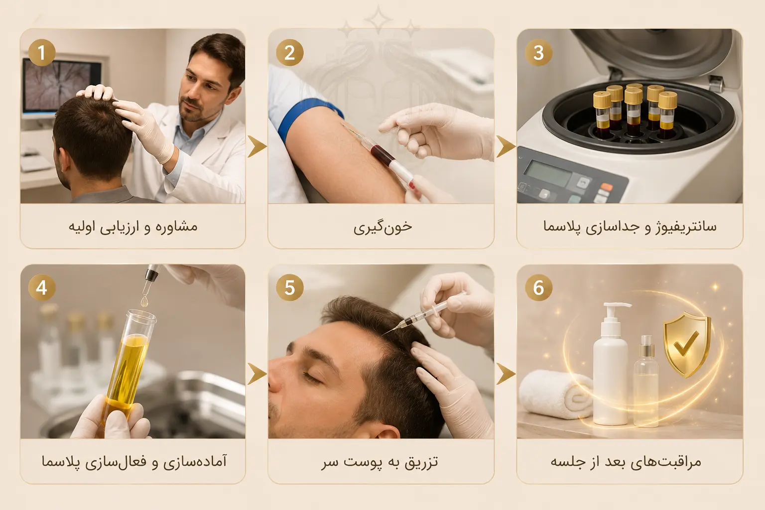 تقویت مو و بازیابی مو به روش PRGF -1