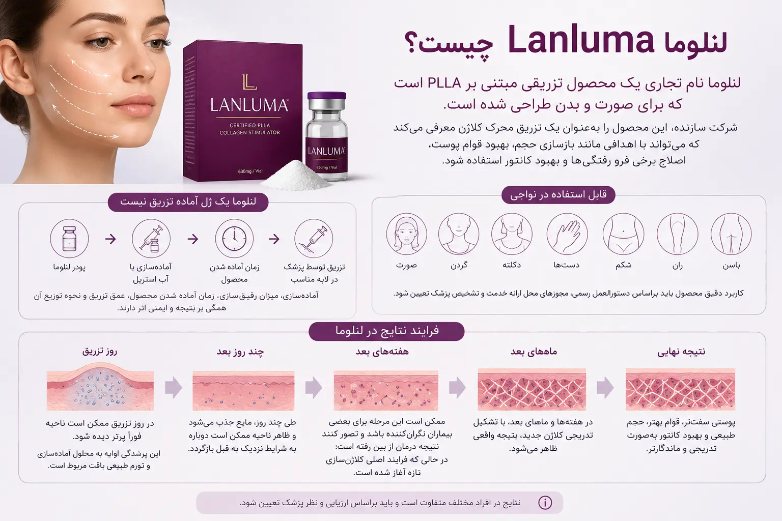 لنلوما Lanluma چیست؟