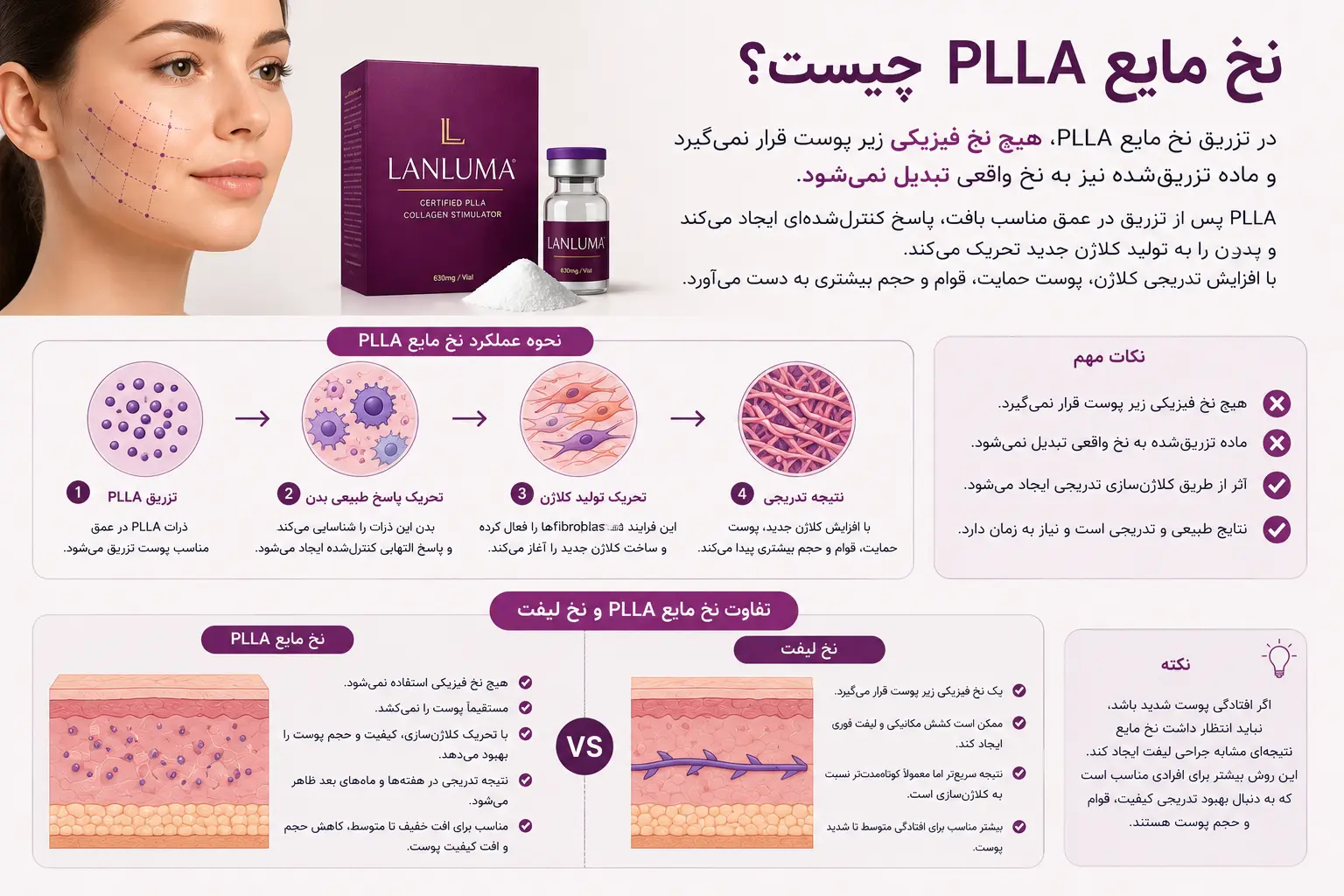 نخ مایع PLLA چیست