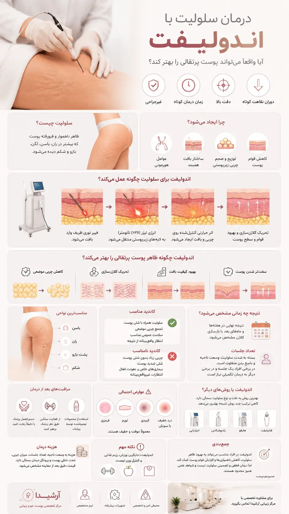 درمان سلولیت با اندولیفت