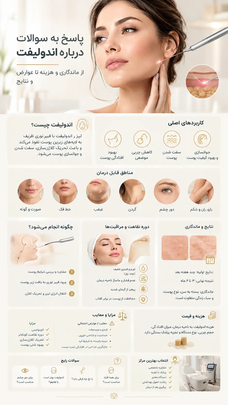 پاسخ به سوالات درباره اندولیفت
