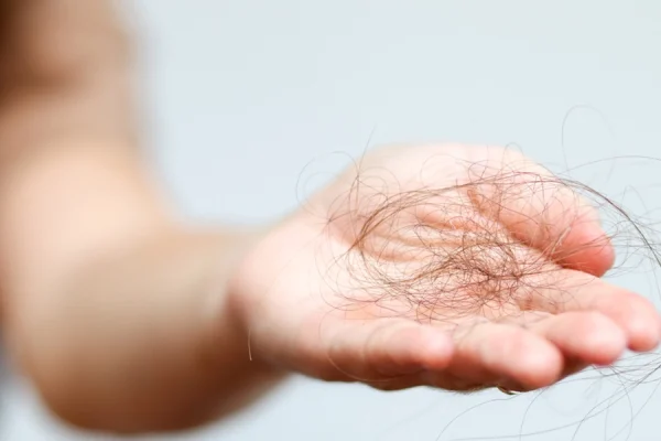 ریزش مو روی دست